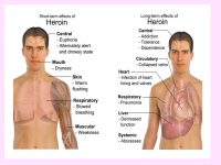 تأثیر کوتاه مدت و بلند مدت مصرف هرویین بر بدن